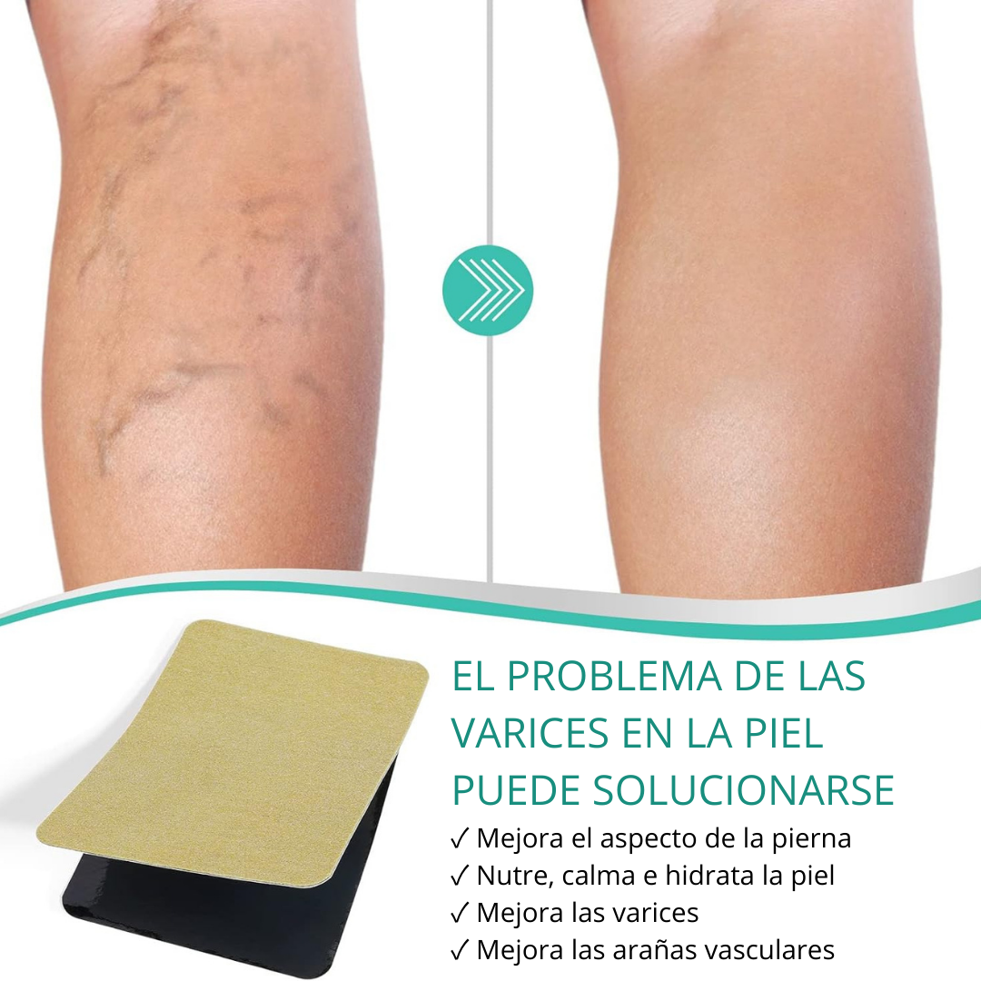 VEINS PARCH ™: ELIMINA VARICES CON FÓRMULA NATURAL🌿 RESULTADOS EN 10 DÍAS👨⚕️  OFERTA ESPECIAL 2X1🎁😵