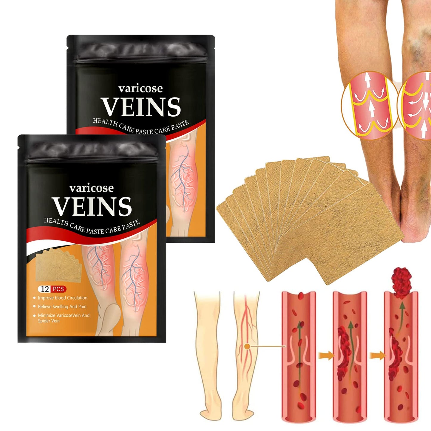 VEINS PARCH ™: ELIMINA VARICES CON FÓRMULA NATURAL🌿 RESULTADOS EN 10 DÍAS👨⚕️  OFERTA ESPECIAL 2X1🎁😵